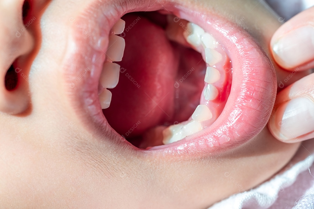 O bebê está abrindo a boca para a mãe usar a mão nos dentes para verificar se os dentes de leite estão prestes a afrouxar