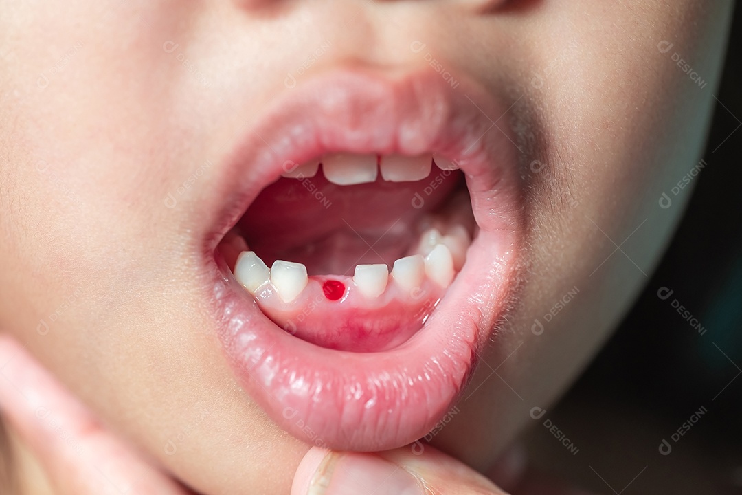 O bebê está abrindo a boca para a mãe usar a mão nos dentes para verificar se os dentes de leite estão prestes a afrouxar