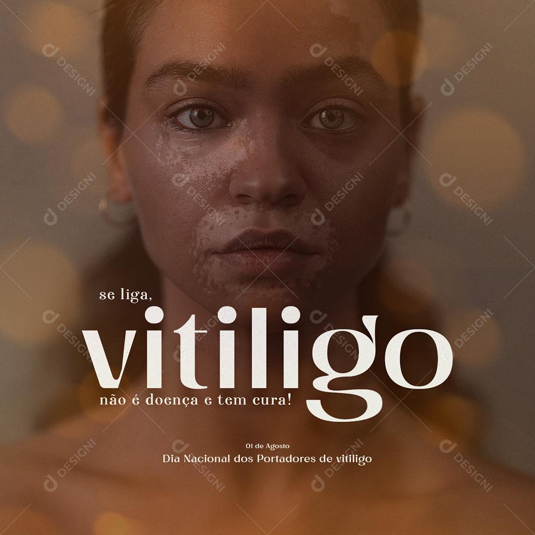 Dia Nacional dos Portadores de Vitiligo 1 de Agosto Social Media PSD Editável