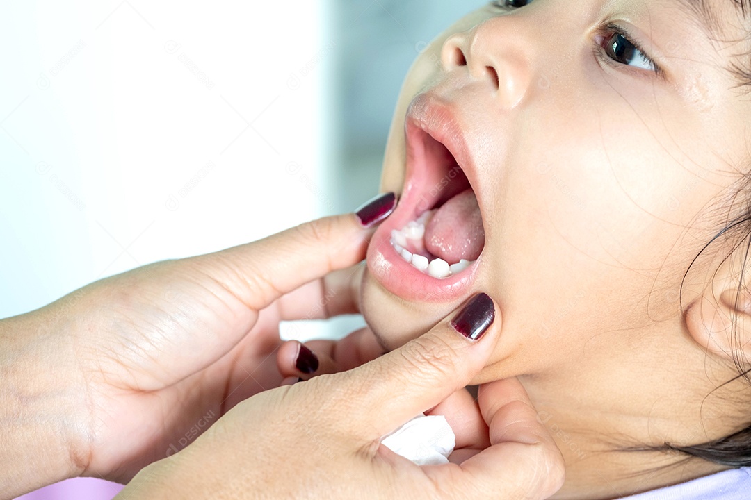 Mão da mãe verificando a saúde bucal da criança Para ver a limpeza dos dentes e da cavidade oral, a criança está abrindo a boca com os dentes brancos.