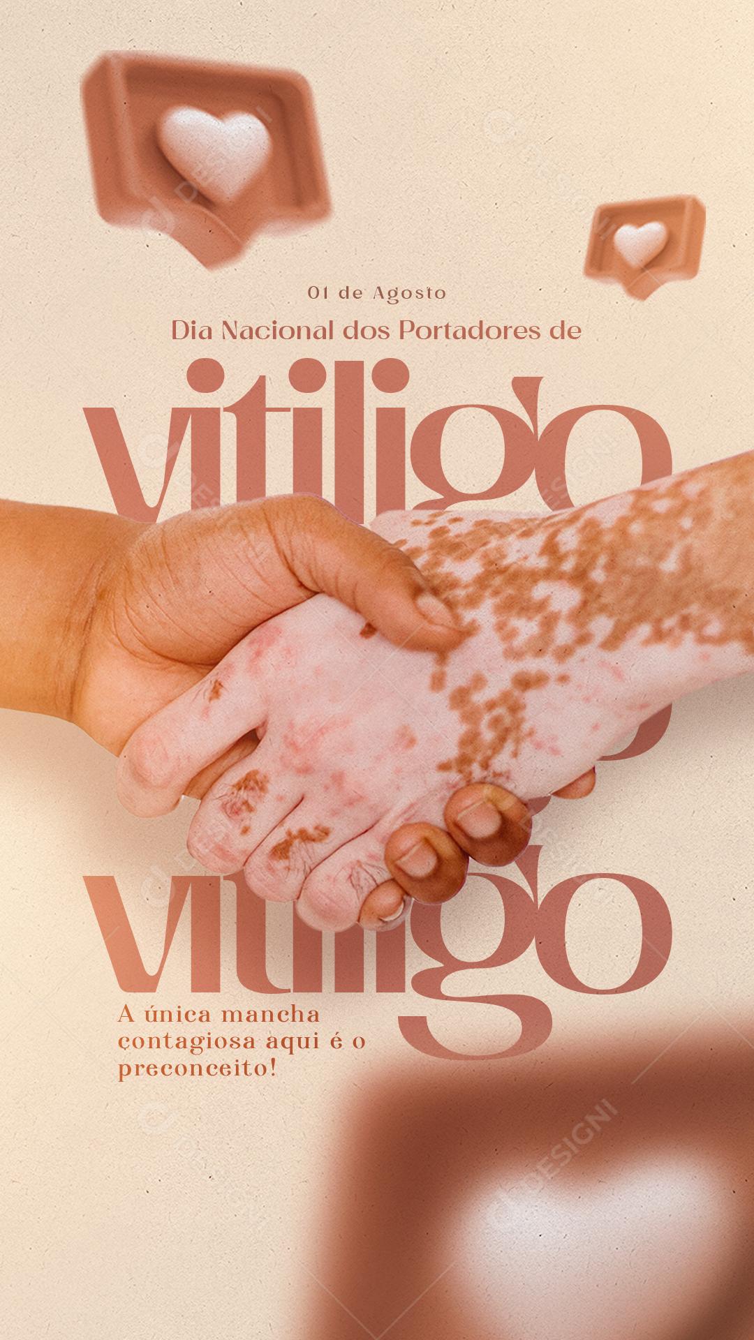 Story A única mancha contagiosa é o preconceito Dia dos Portadores de Vitiligo Social Media PSD Editável