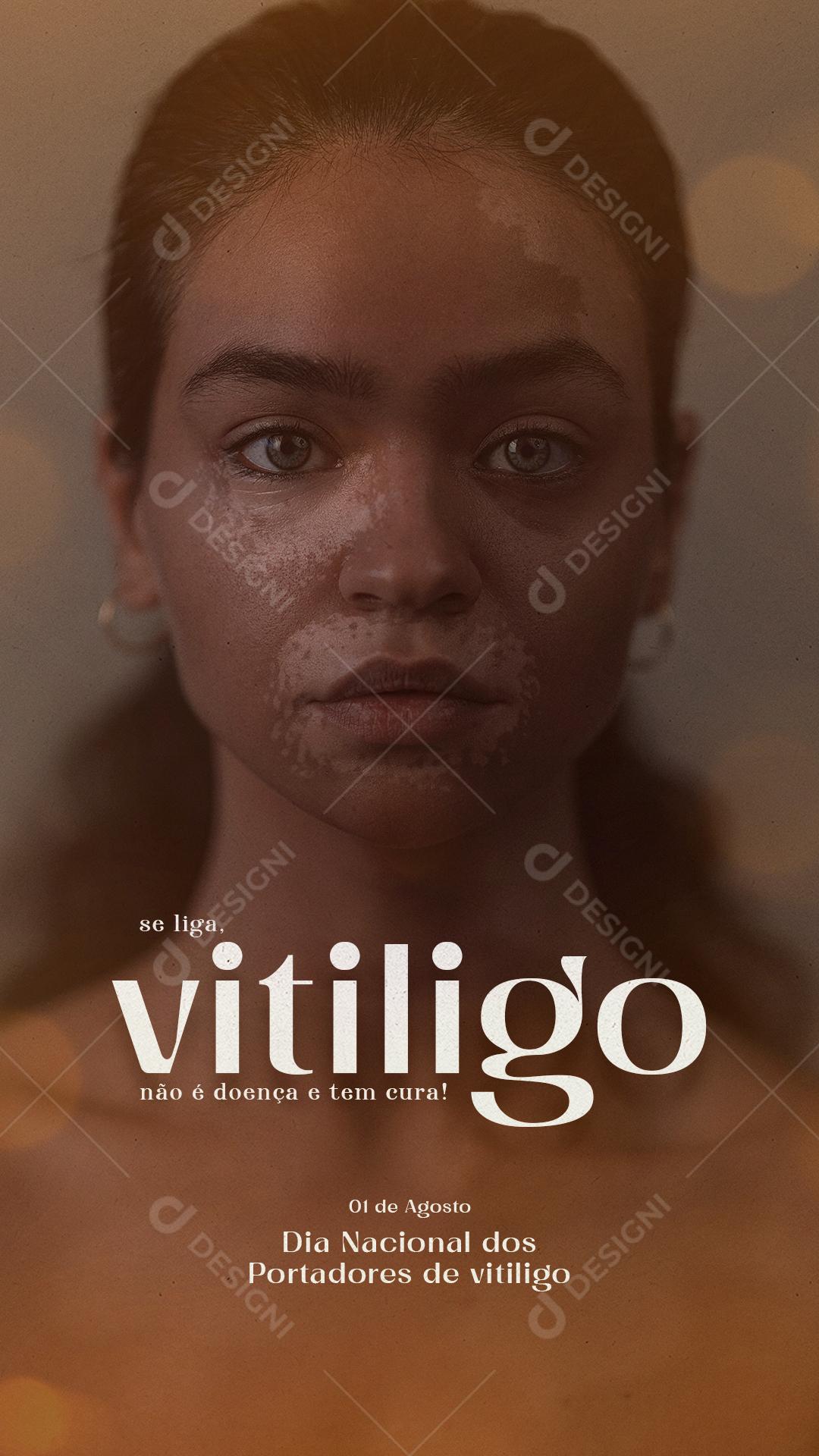 Story Não é doença e tem cura Dia Nacional dos Portadores de Vitiligo Social Media PSD Editável