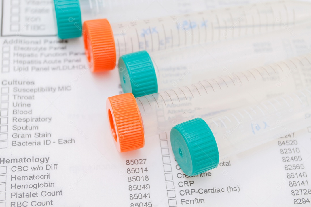 tubo vazio Para as amostras de sangue do experimento e triagem no fundo de triagem de formulário.