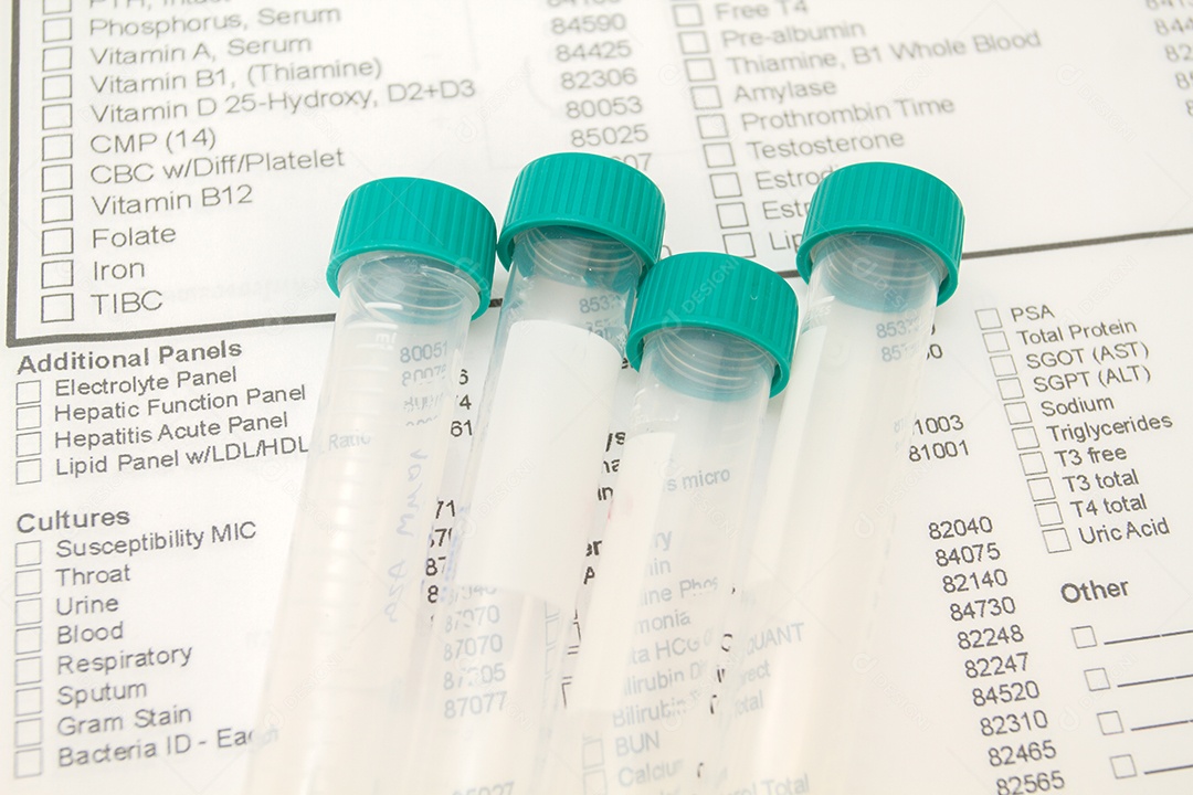 tubo vazio Para as amostras de sangue do experimento e triagem no fundo de triagem de formulário.