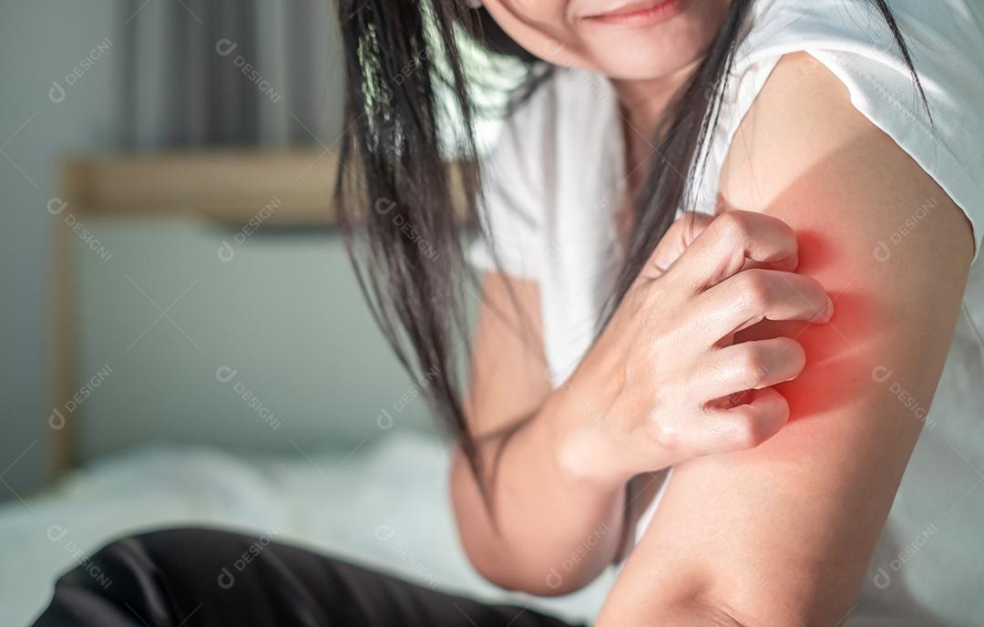 Feche no braço de uma mulher com coceira com a mão em casa, coceira devido a erupção cutânea, fungo, alergia, doença dermatológica, pele seca. Cuidados de saúde e conceito médico.