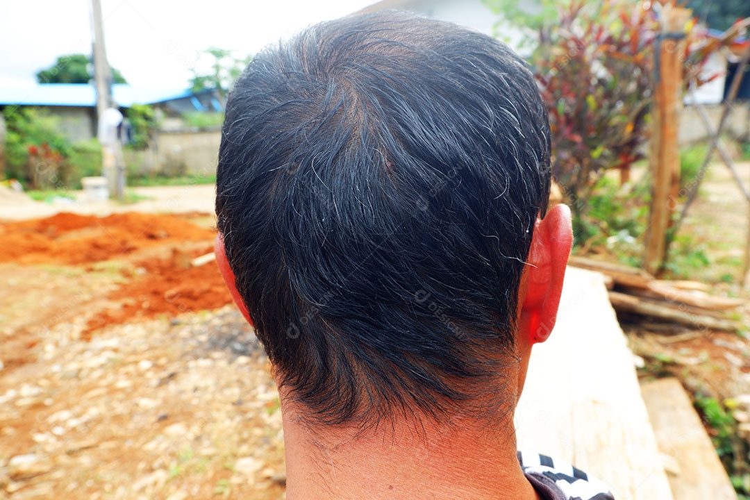 Cabelo do homem asiático é careca.