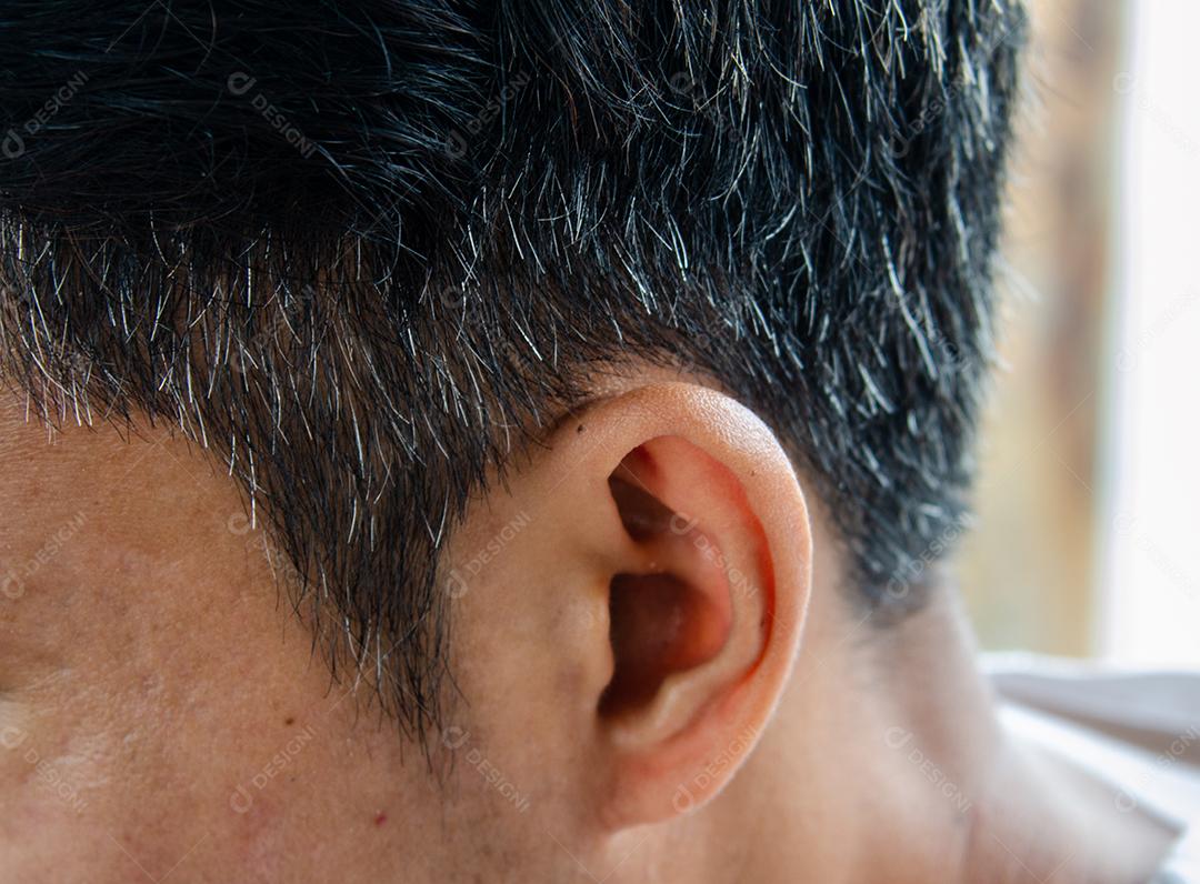 O cabelo branco perde cabelo em um jovem.