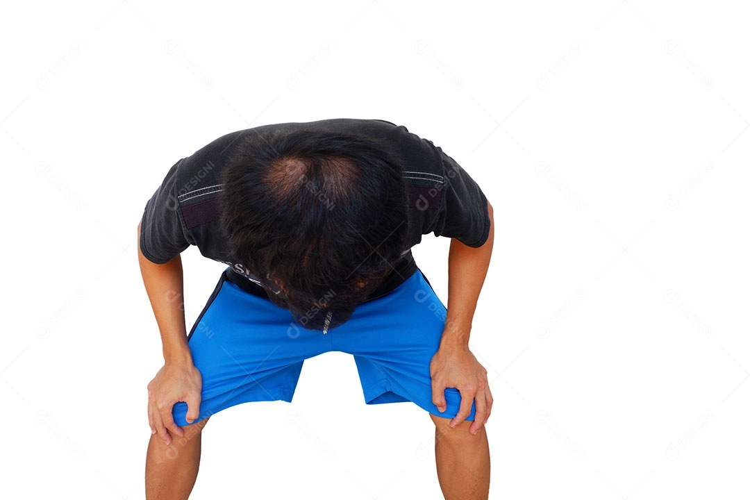 Cabelo na cabeça do homem asiático mostra sintomas de que a cabeça careca