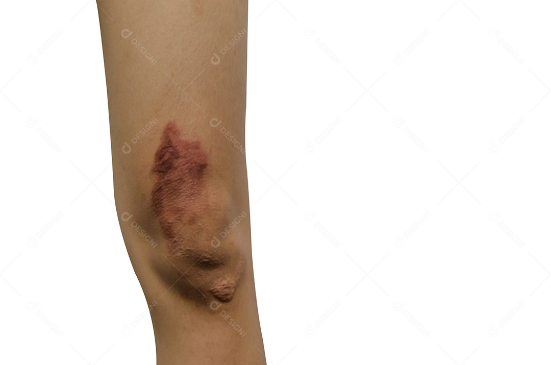 Escalde a perna isolada no fundo branco.