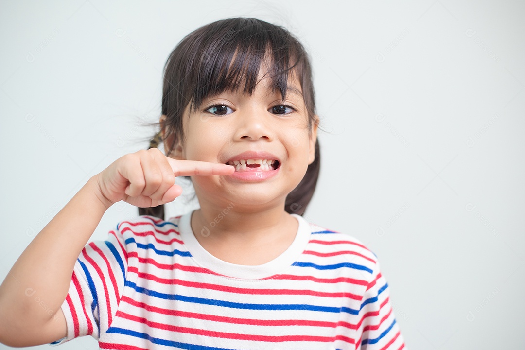 menina asiática mostrando seus dentes de leite quebrados.