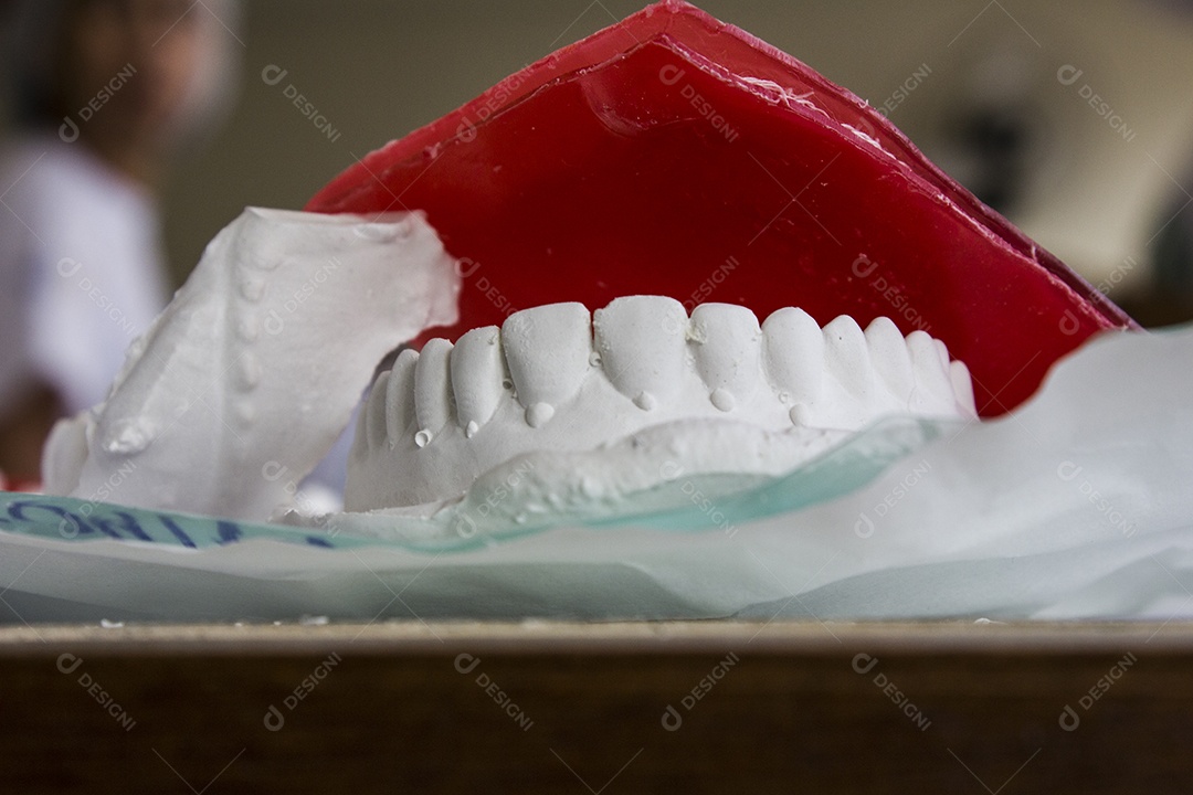 molde de prótese dentária em uma mesa rio de janeiro Brasil.