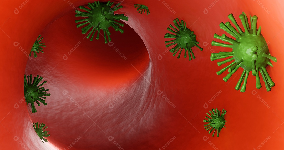 Doença do vírus corona (COVID-19) infecção de ilustração médica. vírus da gripe respiratória