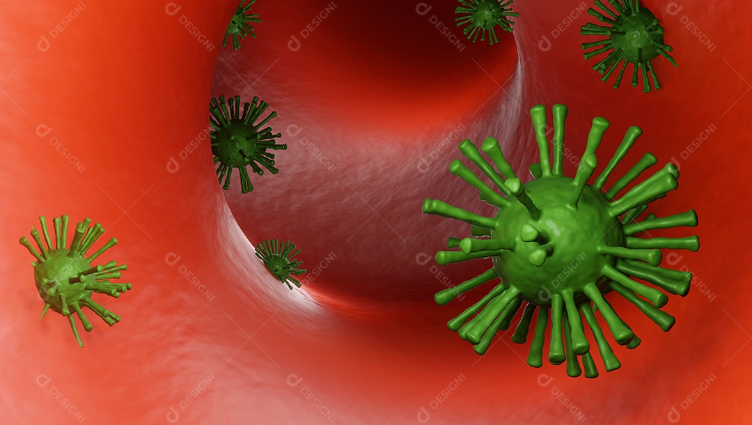 Doença do vírus corona (COVID-19) infecção de ilustração médica. vírus da gripe respiratória