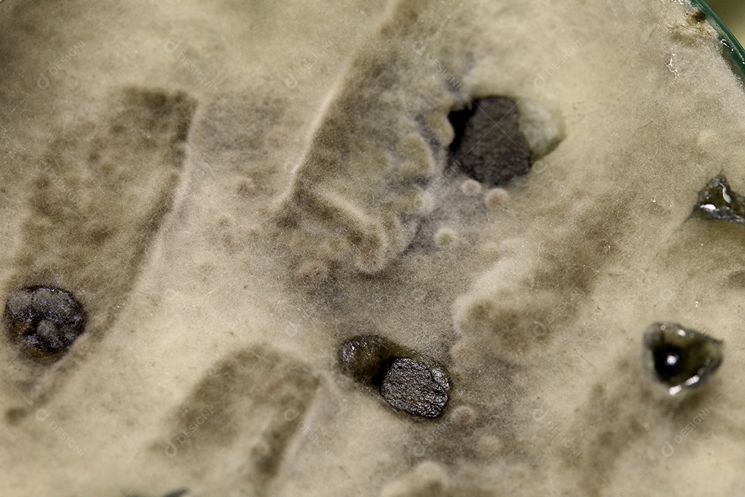 Microscópio cbactérias