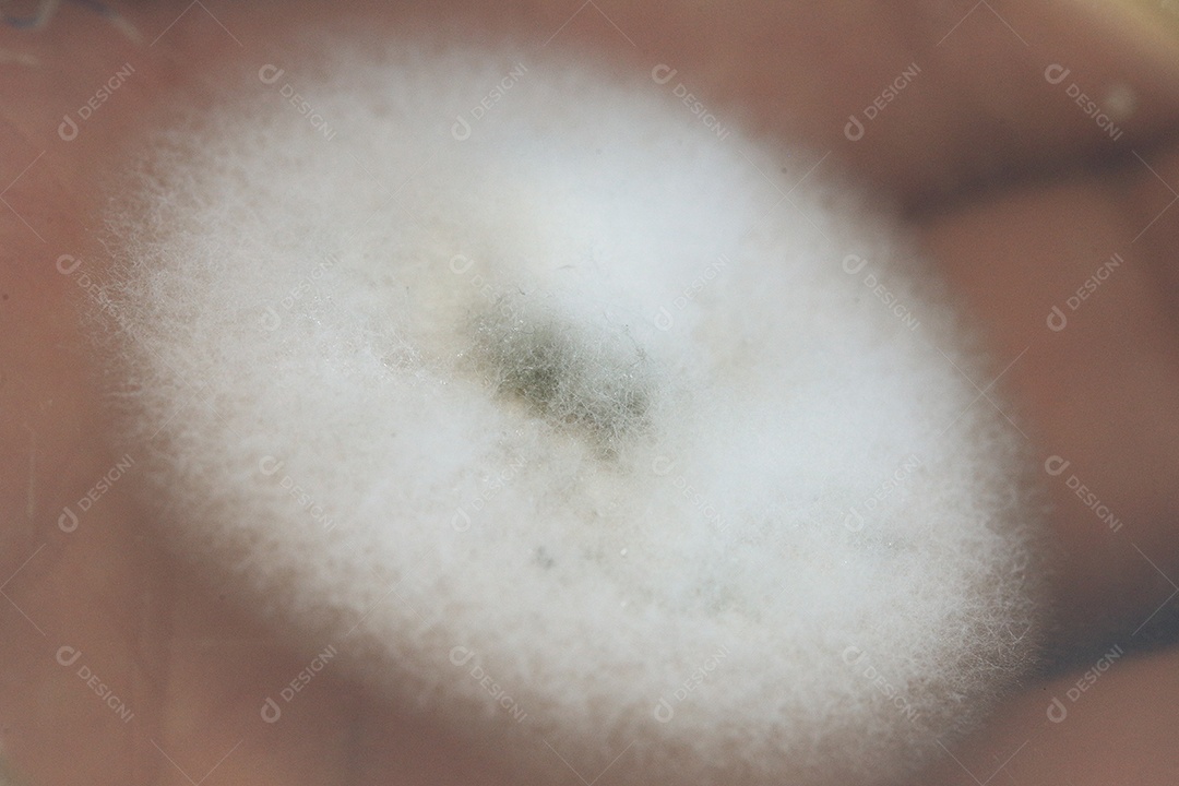 Microscópio fungos bactérias