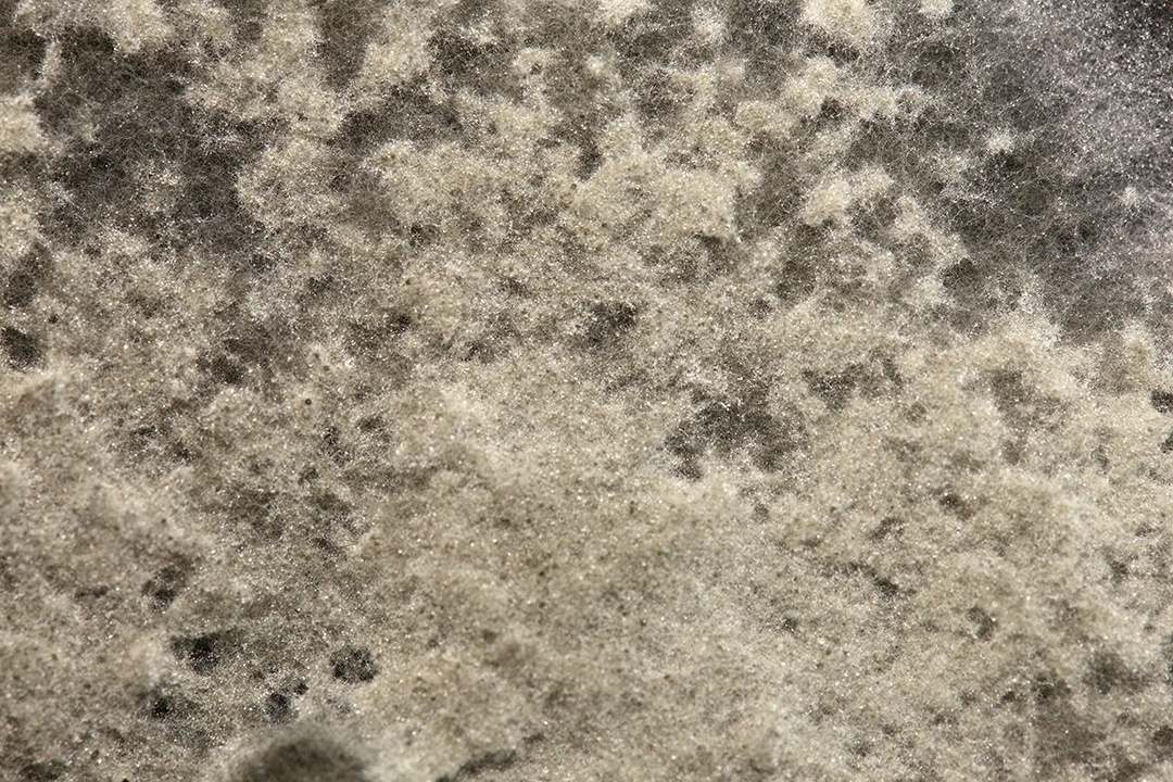 Microscópio fungos bactérias