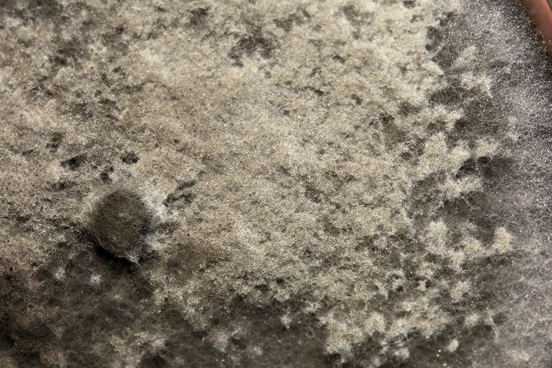 Microscópio fungos bactérias