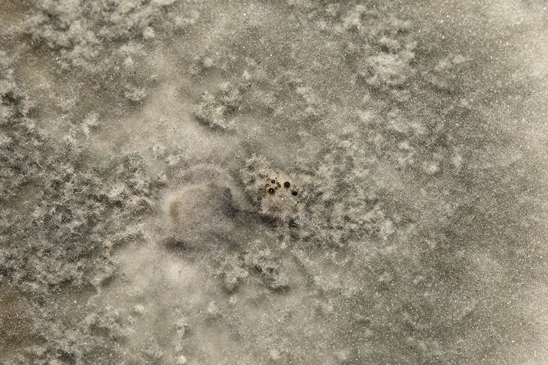 Microscópio fungos bactérias