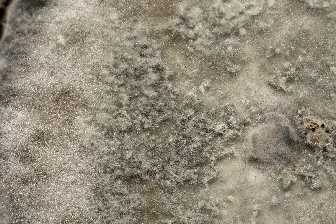 Microscópio fungos bactérias