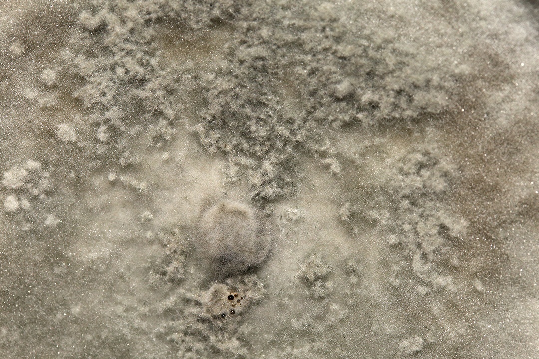 Microscópio fungos bactérias