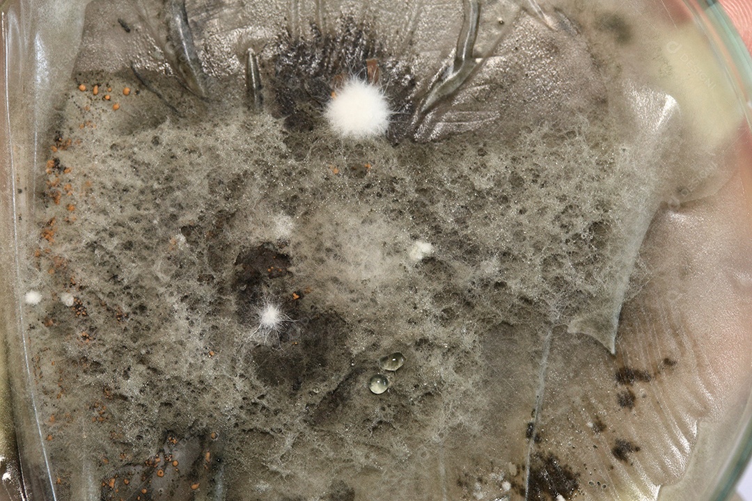 Microscópio fungos bactérias