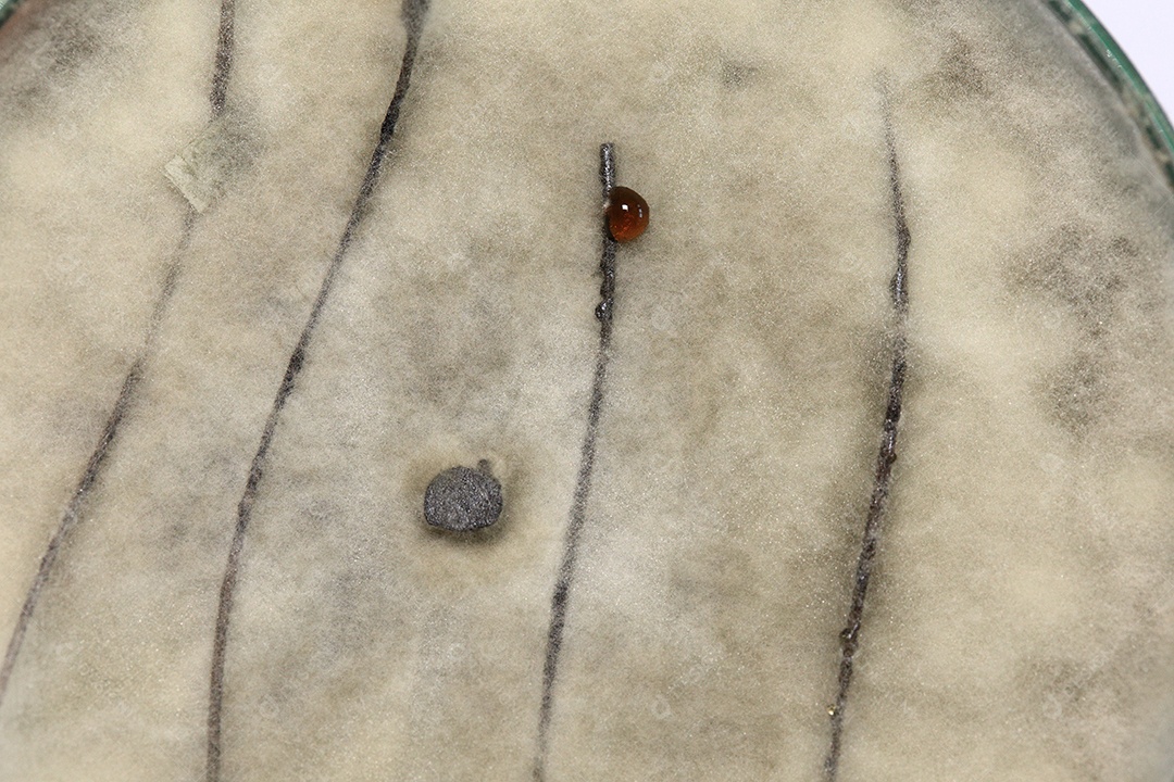 Microscópio fungos bactérias