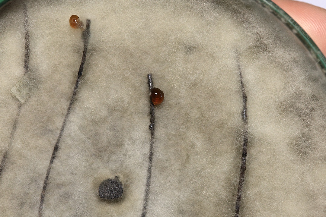 Microscópio fungos bactérias