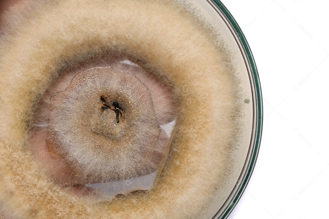 Microscópio fungos bactérias