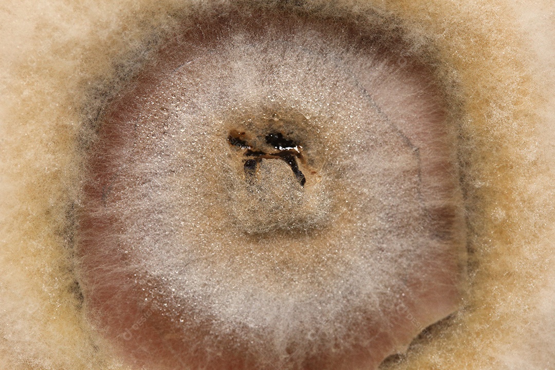 Microscópio fungos bactérias