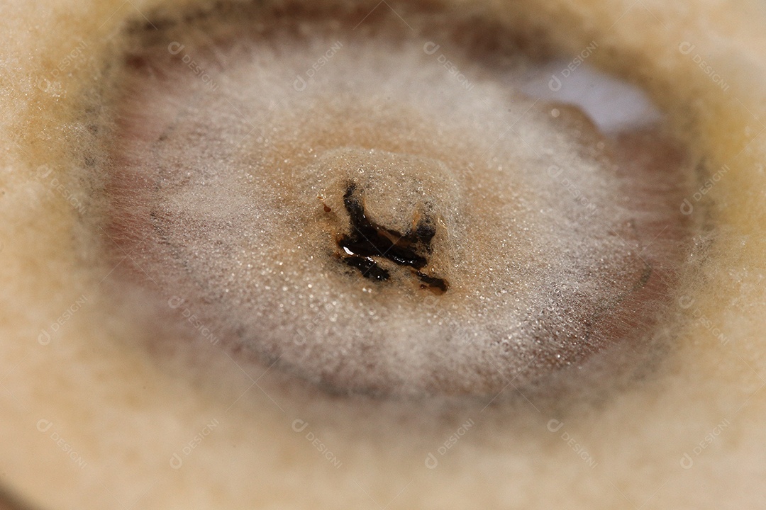 Microscópio fungos bactérias