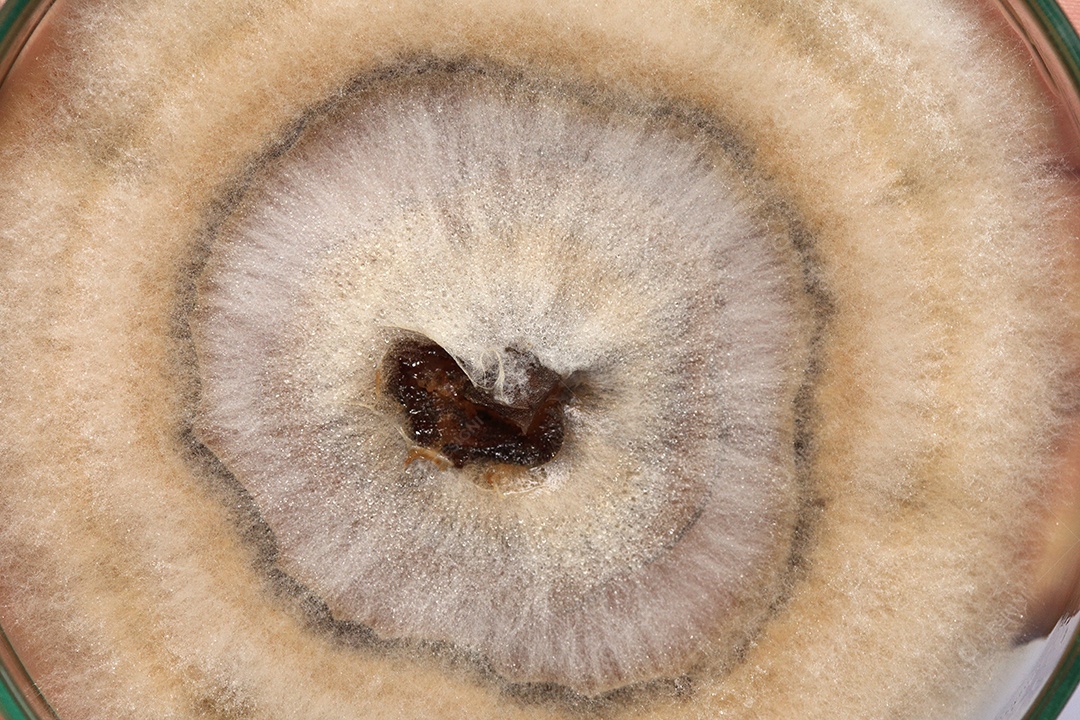 Microscópio fungos bactérias