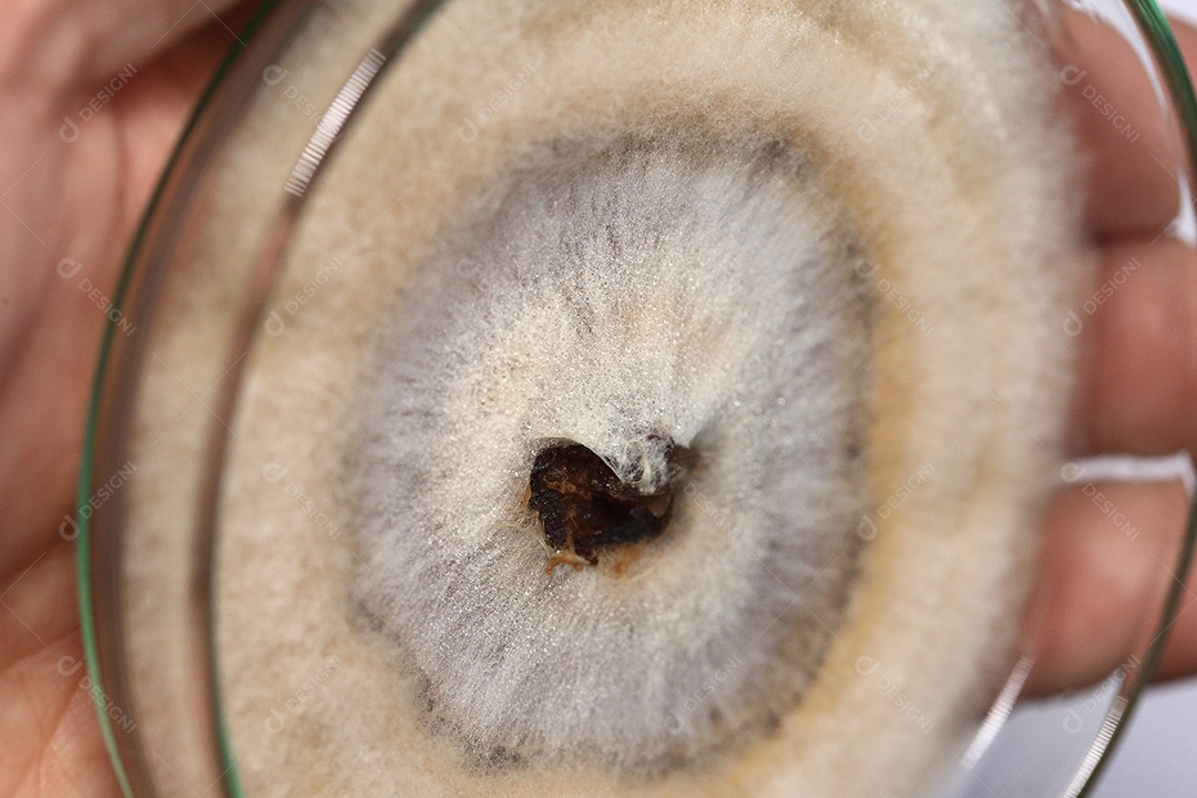 Microscópio fungos bactérias