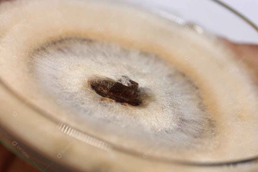 Microscópio fungos bactérias