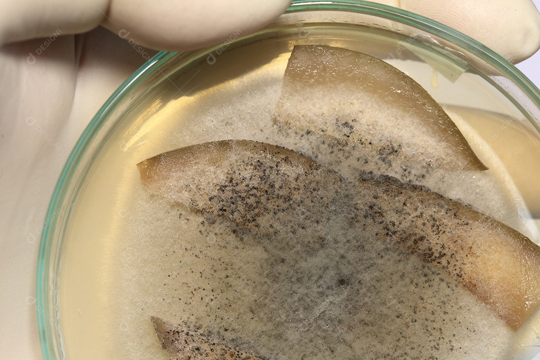 Microscópio fungos bactérias