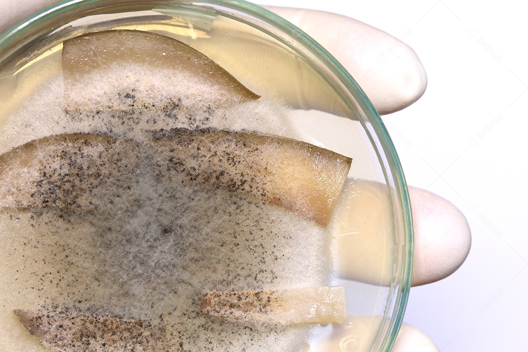 Microscópio fungos bactérias