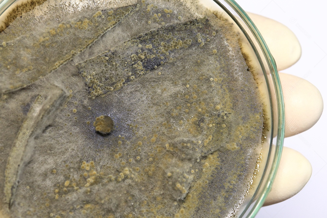 Microscópio fungos bactérias