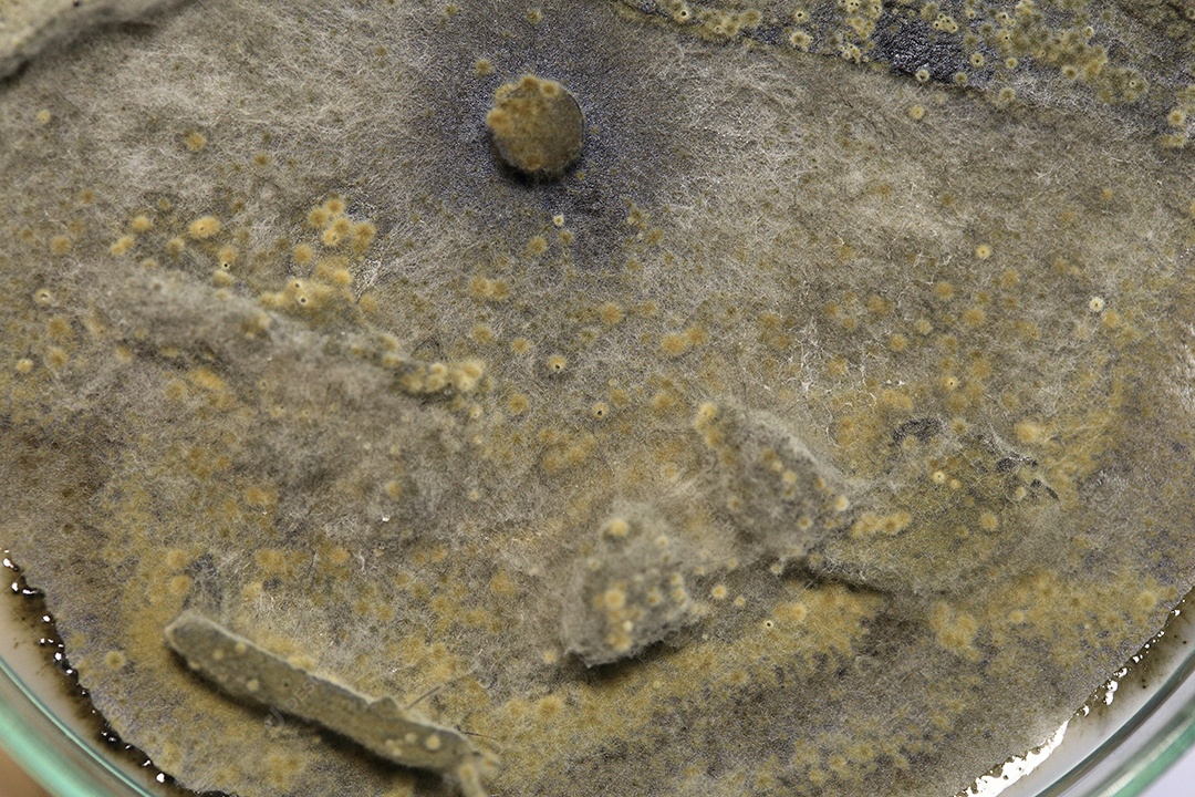 Microscópio fungos bactérias