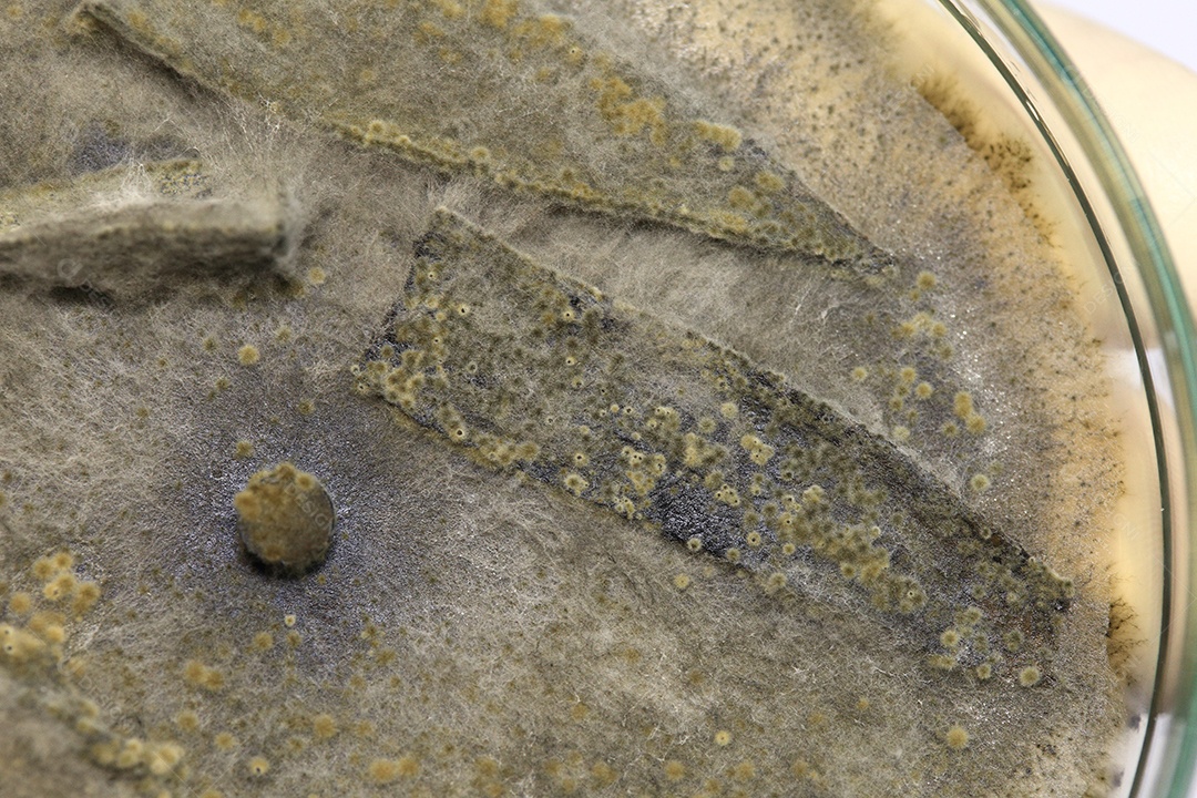 Microscópio fungos bactérias