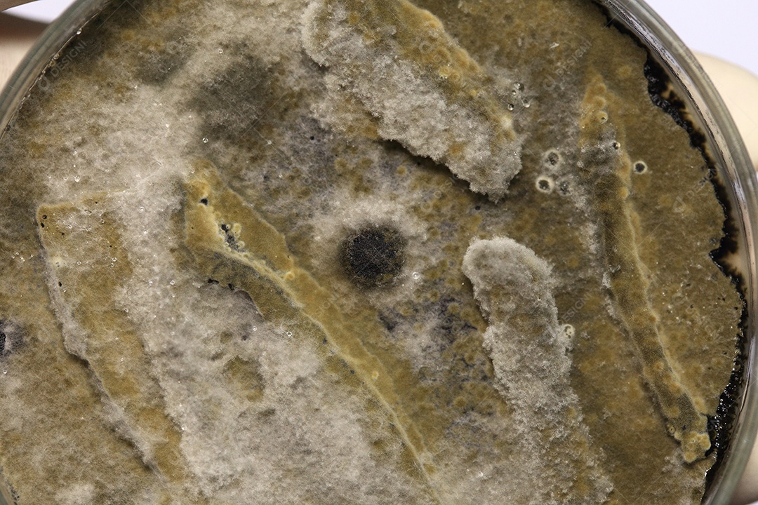 Microscópio fungos bactérias