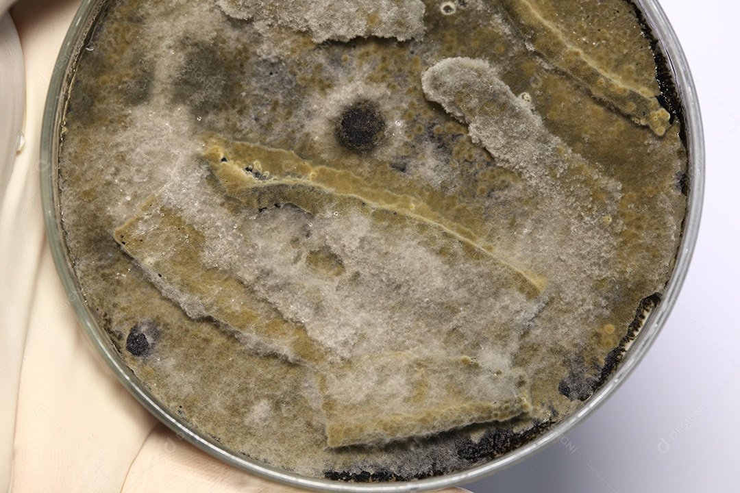 Microscópio fungos bactérias