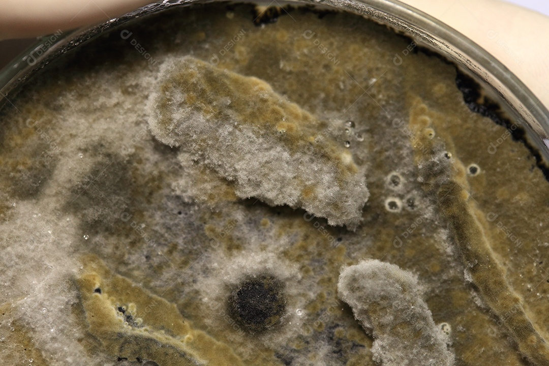 Microscópio fungos bactérias