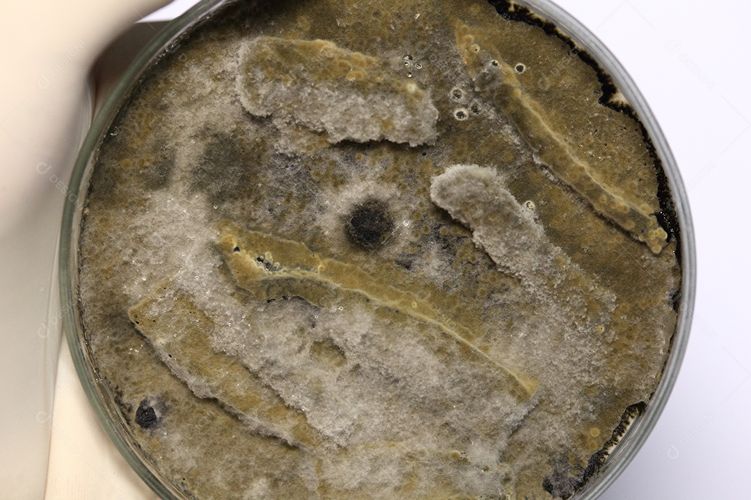 Microscópio fungos bactérias