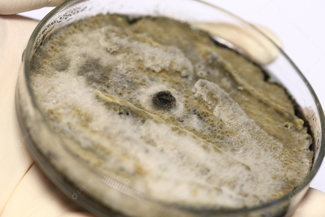 Microscópio fungos bactérias