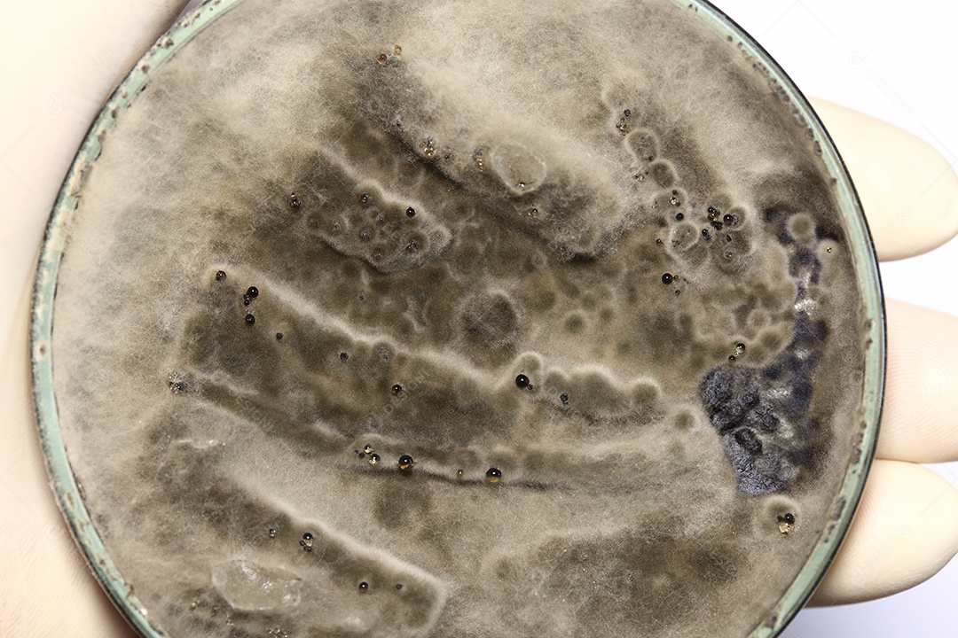 Microscópio fungos bactérias