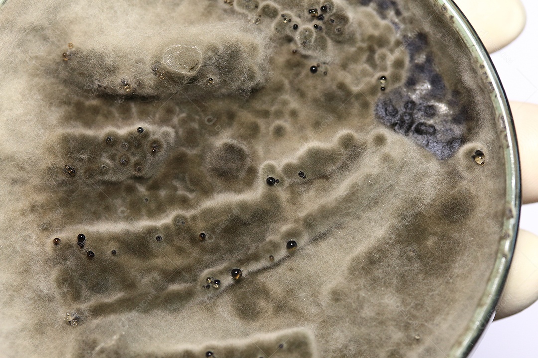 Microscópio fungos bactérias