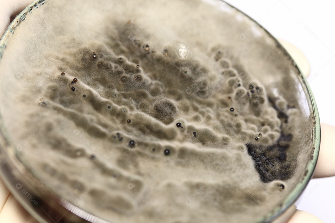 Microscópio fungos bactérias