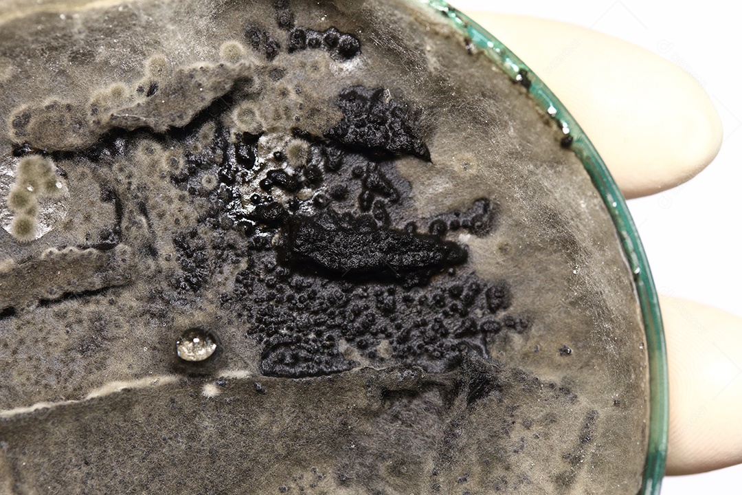 Microscópio fungos bactérias