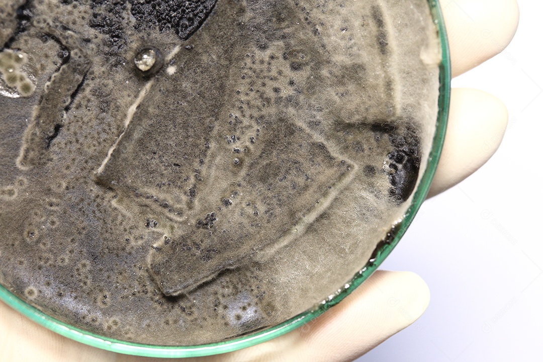 Microscópio fungos bactérias