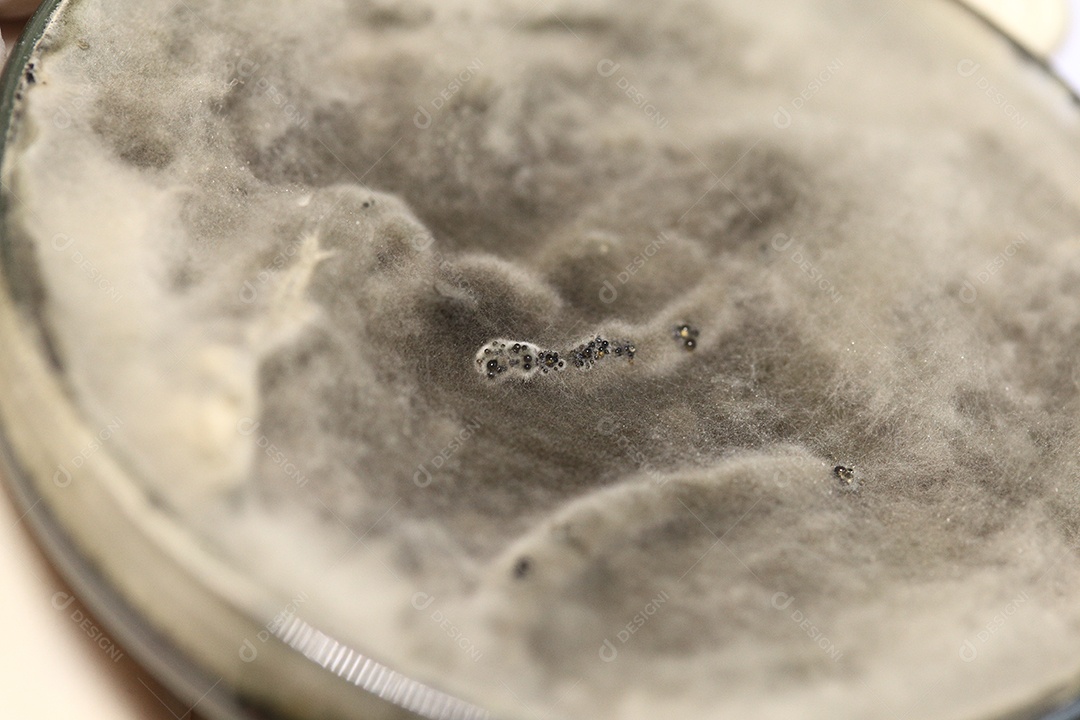 Microscópio fungos bactérias