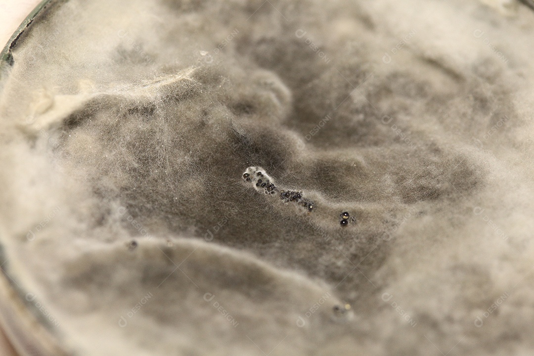 Microscópio fungos bactérias